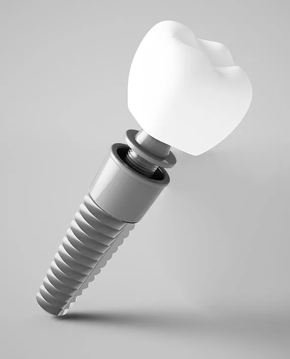 close up of single tooth dental implant on grey background