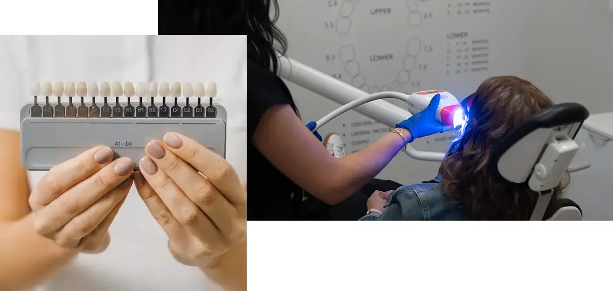 Collage of patient undergoing teeth whitening procedure and close up of tooth shade guide